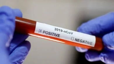 Photo of अमेठी में लगातार कोरोना का कहर जारी। दो पॉजिटिव मिले जायस में। अब अमेठी में कुल संक्रमित मरीजों की संख्या हो गई है 13